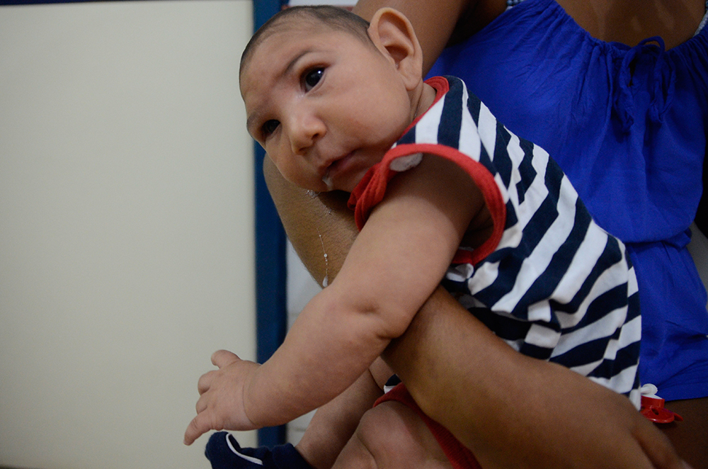 baby with microcephaly small head